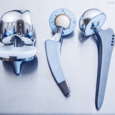 Discover More About Your Longview Personal Injury Law Firm. Call Now.