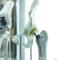 This model shows why the DePuy Hip Implant Recall was issued.
